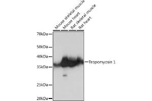 Western blot analysis of extracts of various cell lines, using Tropomyosin 1 Rabbit mAb (ABIN7271013) at 1:1000 dilution. (Tropomyosin anticorps)