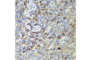 Immunohistochemistry of paraffin-embedded human tonsil using IL18 antibody (ABIN7267992) at dilution of 1:50 (40x lens). (IL-18 anticorps)