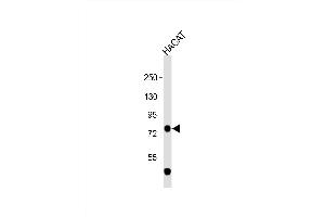 Western Blot at 1:1000 dilution + HACAT whole cell lysate Lysates/proteins at 20 ug per lane.