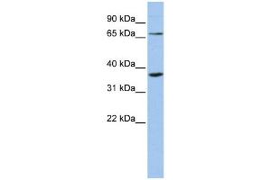 WB Suggested Anti-ZNF274  Antibody Titration: 0. (ZNF274 anticorps  (Middle Region))