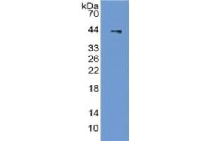 Rabbit Capture antibody from the kit in WB with Positive Control: Sample Rat Stomach lysate.