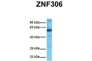 Host:  Rabbit  Target Name:  ZNF306  Sample Tissue:  Human Ovary Tumor  Antibody Dilution:  1.