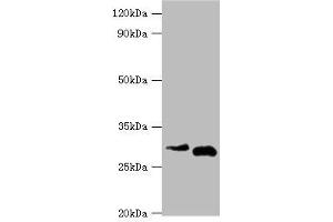 Western blot All lanes: Cerberus antibody at 2 μg/mL Lane 1: Hela whole cell lysate Lane 2: Rat kidney tissue Secondary Goat polyclonal to rabbit IgG at 1/10000 dilution Predicted band size: 30 kDa Observed band size: 30 kDa (CER1 anticorps  (AA 18-267))