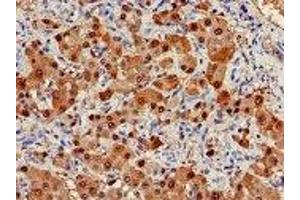 Immunohistochemistry (IHC) image for anti-Arginase, Liver (ARG1) (AA 1-322) antibody (ABIN6091459)
