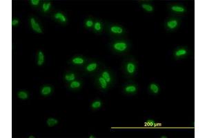 Image no. 3 for anti-TATA Box Binding Protein Associated Factor 11 (TAF11) (AA 158-211) antibody (ABIN598956) (TAF11 anticorps  (AA 158-211))