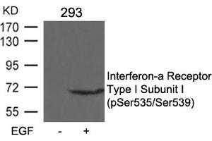 Western blot analysis of extracts from 293 cells untreated or treated with EGF using Interferon-a Receptor Type I Subunit I (phospho-Ser535/Ser539) Antibody.