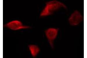 ABIN6267231 staining HepG2 by IF/ICC.