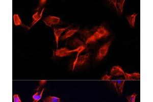 Immunofluorescence analysis of U-2 OS cells using CLUH Polyclonal Antibody at dilution of 1:100 (40x lens). (CLUH anticorps)