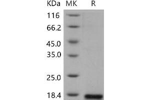 Western Blotting (WB) image for Phospholipase A2, Group IIE (PLA2G2E) protein (His tag) (ABIN7320192)