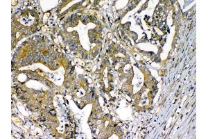 IHC analysis of Factor D using anti-Factor D antibody . (Adipsin anticorps  (AA 26-253))