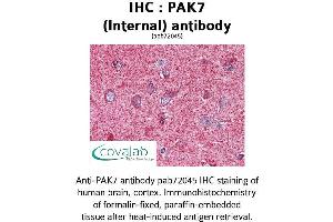 Image no. 1 for anti-P21 Protein (Cdc42/Rac)-Activated Kinase 7 (PAK7) (Internal Region) antibody (ABIN1737840) (PAK7 anticorps  (Internal Region))