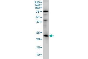 RAB3A monoclonal antibody (M01), clone 4H7 Western Blot analysis of RAB3A expression in IMR-32 . (RAB3A anticorps  (AA 122-220))