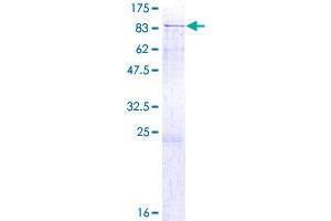 Image no. 1 for E3 Ubiquitin-protein ligase DTX1 (DTX1) (AA 1-620) protein (GST tag) (ABIN1352066)