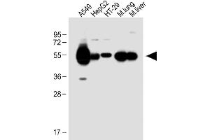 All lanes : Anti-ALDH1A1 Antibody (Center) at 1:1000 dilution Lane 1: A549 whole cell lysate Lane 2: HepG2 whole cell lysate Lane 3: HT-29 whole cell lysate Lane 4: Mouse lung lysate Lane 5: Mouse liver lysate Lysates/proteins at 20 μg per lane. (ALDH1A1 anticorps  (AA 306-339))