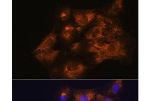 Immunofluorescence analysis of C6 cells using C1 Inactivator Polyclonal Antibody at dilution of 1:100. (SERPING1 anticorps)