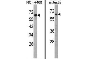 Image no. 1 for anti-Fascin 3 (FSCN3) (N-Term) antibody (ABIN452991) (Fascin 3 anticorps  (N-Term))