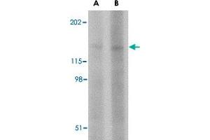 Western blot analysis of BAIAP3 in SK-N-SH cell lysate with BAIAP3 polyclonal antibody  at (A) 1 and (B) 2 ug/mL .