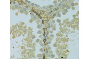 Immunohistochemistry of paraffin-embedded Rat testis using KCNJ1 Polyclonal Antibody at dilution of 1:100 (40x lens). (KCNJ1 anticorps)