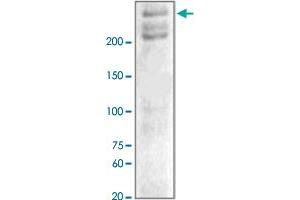 The tissue lysates derived from hypoxic mouse brain were immunoblotted by NF1 polyclonal antibody  at 1 : 1000. (Neurofibromin 1 anticorps  (C-Term))