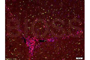 anti-Keratin 18 (KRT18) (AA 53-150) antibody