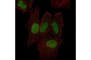 Immunofluorescence analysis of Hela cells using MAP2K7 mouse mAb (green).