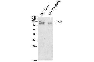 Western Blotting (WB) image for anti-Signal Transducer and Activator of Transcription 1, 91kDa (STAT1) (Internal Region) antibody (ABIN3188009) (STAT1 anticorps  (Internal Region))