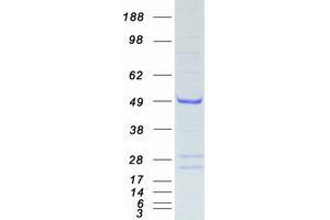 Validation with Western Blot