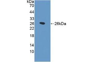 Western blot analysis of recombinant Rat SPB. (SFTPB anticorps  (AA 111-329))