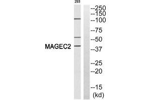 Western Blotting (WB) image for anti-Melanoma Antigen Family C, 2 (MAGEC2) (Internal Region) antibody (ABIN1852688) (MAGEC2 anticorps  (Internal Region))