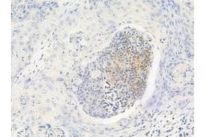 anti-Heterogeneous Nuclear Ribonucleoprotein C-Like 1 (HNRNPCL1) (C-Term) antibody