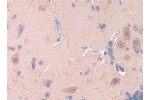 Detection of LEP in Rat Brain Tissue using Polyclonal Antibody to Leptin (LEP) (Leptin anticorps  (AA 22-167))
