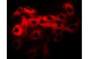Immunofluorescent analysis of Tropomyosin staining in Hela cells. (Tropomyosin anticorps)
