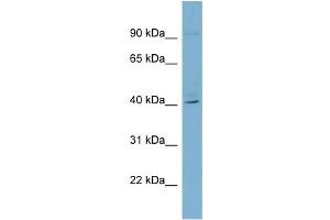 WB Suggested Anti-RFPL3 Antibody Titration: 0. (RFPL3 anticorps  (Middle Region))