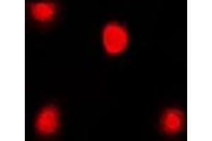 Immunofluorescent analysis of FKBP4 staining in Jurkat cells. (FKBP4 anticorps)