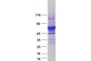 Validation with Western Blot