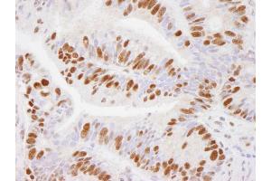 Immunohistochemistry (IHC) image for anti-Ubiquitin Specific Peptidase 7 (Herpes Virus-Associated) (USP7) (AA 1-50) antibody (ABIN7449033)
