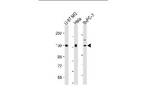 All lanes : Anti-MGEA5 Antibody (N-Term) at 1:2000 dilution Lane 1: U-87 MG whole cell lysate Lane 2: Hela whole cell lysate Lane 3: BxPC-3 whole cell lysate Lysates/proteins at 20 μg per lane. (MGEA5 anticorps  (AA 236-269))