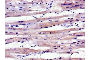 Immunohistochemistry of paraffin-embedded human heart tissue using ABIN7143036 at dilution of 1:100 (ABLIM1 anticorps  (AA 174-319))