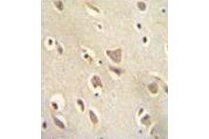 Immunohistochemistry analysis in formalin fixed and paraffin embedded human brain tissue reacted with MCHR1 / GPR24 Antibody (C-term) followed which was peroxidase conjugated to the secondary antibody and followed by DAB staining.