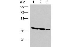 Western blot analysis of HT-29 K562 and HUVEC cell lysates using GIMAP2 Polyclonal Antibody at dilution of 1:1000 (GIMAP2 anticorps)