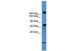 Image no. 1 for anti-Rearranged L-Myc Fusion (RLF) (AA 20-69) antibody (ABIN6745418) (RLF anticorps  (AA 20-69))