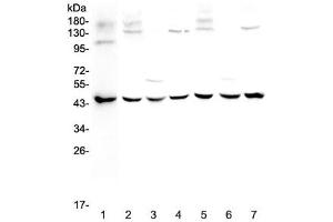 Western blot testing of 1) human MCF7, 2) rat brain, 3) rat kidney, 4) rat testis, 5) mouse brain, 6) mouse kidney and 7) mouse testis lysate with WWOX antibody at 0. (WWOX anticorps)