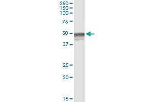 Immunoprecipitation of HYAL3 transfected lysate using anti-HYAL3 MaxPab rabbit polyclonal antibody and Protein A Magnetic Bead , and immunoblotted with HYAL3 purified MaxPab mouse polyclonal antibody (B01P) . (HYAL3 anticorps  (AA 1-417))