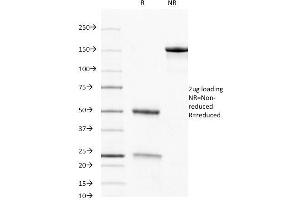 SDS-PAGE Analysis Purified CD8 Mouse Monoclonal Antibody (C8/468).