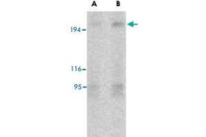 Western blot analysis of TSC2 in L1210 cell lysate with TSC2 polyclonal antibody  at (A) 2 and (B) 4 ug/mL . (Tuberin anticorps  (N-Term))