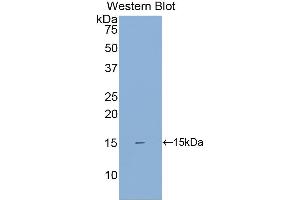 Detection of Recombinant SIGIRR, Human using Polyclonal Antibody to Single Ig IL1 Related Receptor (SIGIRR)