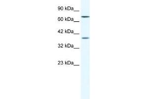 Human HepG2; WB Suggested Anti-ZNF660 Antibody Titration: 1. (ZNF660 anticorps  (C-Term))