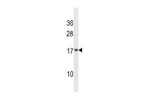 Western blot analysis in NCI-H292 cell line lysates (35ug/lane). (VAMP4 anticorps  (AA 61-90))