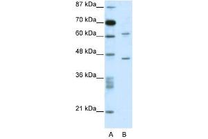 C1ORF25 antibody used at 0. (TRMT1L anticorps  (N-Term))