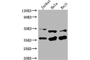 Western Blot Positive WB detected in: Jurkat whole cell lysate, Hela whole cell lysate, Raji whole cell lysate All lanes: NFKBIA antibody at 1:2000 Secondary Goat polyclonal to rabbit IgG at 1/50000 dilution Predicted band size: 36 kDa Observed band size: 36 kDa